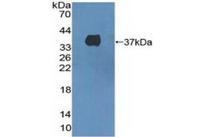 Detection of Recombinant HGFR, Human using Polyclonal Antibody to C-Met (MET) (c-MET antibody  (AA 1092-1379))