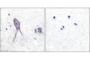 Immunohistochemistry analysis of paraffin-embedded human brain tissue, using Notch 2 (Cleaved-Asp1733) Antibody. (NOTCH2 antibody  (Cleaved-Asp1733))