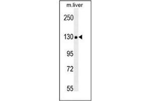 Western blot analysis in mouse liver tissue lysates (35ug/lane) using COL18A1 Antibody (Center) Cat. (COL18A1 antibody  (Chain alpha 1, Middle Region))