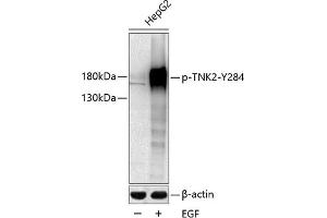 Western blot analysis of extracts of HepG2 cells, using Phospho-TNK2-Y284 antibody (ABIN6135329, ABIN6136274, ABIN6136275 and ABIN6225608) at 1:1000 dilution. (TNK2 antibody  (pTyr284))