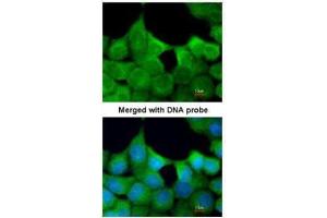 ICC/IF Image Immunofluorescence analysis of paraformaldehyde-fixed A431, using EXOC7, antibody at 1:200 dilution. (EXOC7 antibody)