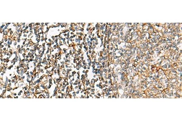 Choline Kinase alpha antibody