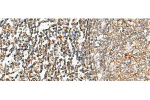 Immunohistochemistry of paraffin-embedded Human tonsil tissue using CHKA Polyclonal Antibody at dilution of 1:35(x200)