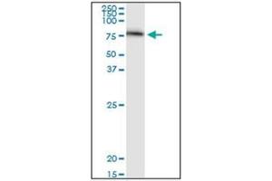 Western Blotting (WB) image for anti-Serpin Peptidase Inhibitor, Clade G (C1 Inhibitor), Member 1 (SERPING1) (AA 1-501) antibody (ABIN782340) (SERPING1 antibody  (AA 1-501))