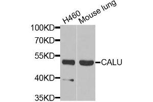 Western blot analysis of extracts of H460 and mouse lung cells, using CALU antibody. (CALU antibody)