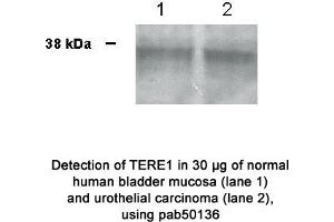 Image no. 1 for anti-UbiA Prenyltransferase Domain Containing 1 (UBIAD1) (N-Term) antibody (ABIN363445) (UBIAD1 antibody  (N-Term))