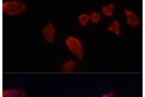 Immunofluorescence analysis of HeLa cells using CA9 Polyclonal Antibody at dilution of 1:100. (CA9 antibody)