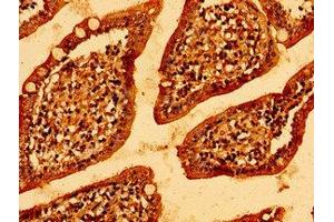Immunohistochemistry of paraffin-embedded human small intestine tissue using ABIN7146314 at dilution of 1:100 (MCU antibody  (AA 155-233))