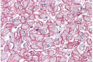 Human Heart: Formalin-Fixed, Paraffin-Embedded (FFPE) (SGCB antibody  (AA 87-197))