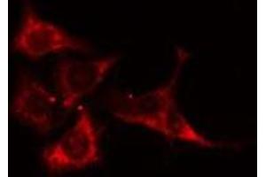 ABIN6275132 staining MCF7 cells by IF/ICC. (ALDOB antibody  (C-Term))