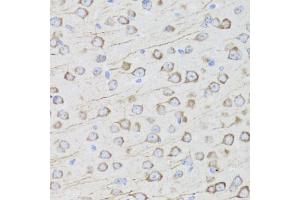 Immunohistochemistry of paraffin-embedded mouse brain using MIP antibody (ABIN5971491) at dilution of 1/100 (40x lens). (MIP antibody)