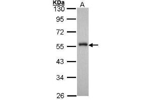 Western Blotting (WB) image for anti-Forkhead Box A1 (FOXA1) (C-Term) antibody (ABIN2854707)