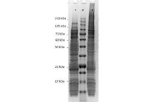 SDS-PAGE results of E.