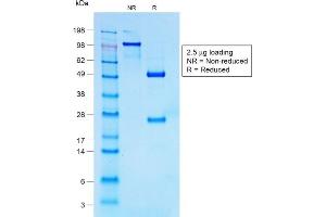 SDS-PAGE Analysis of Purified CD30 Rabbit Recombinant Monoclonal Antibody (Ki-1/1747R).