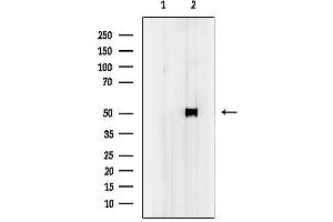 anti-KRT37,38 (C-Term) antibody