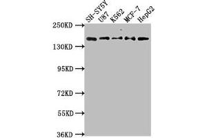Western Blot Positive WB detected in: SH-SY5Y whole cell lysate, U87 whole cell lysate, K562 whole cell lysate, MCF-7 whole cell lysatee, HepG2 whole cell lysate All lanes: INSRR antibody at 1:2000 Secondary Goat polyclonal to rabbit IgG at 1/50000 dilution Predicted band size: 144 kDa Observed band size: 144 kDa (INSRR antibody  (AA 747-921))