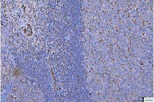 IHC analysis of Vimentin using anti-Vimentin antibody (ABIN3042344).