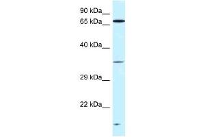 Western Blot showing VPS26A antibody used at a concentration of 1 ug/ml against Fetal Kidney Lysate (VPS26A antibody  (C-Term))