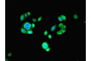 Immunofluorescent analysis of PC-3 cells using ABIN7164973 at dilution of 1:100 and Alexa Fluor 488-congugated AffiniPure Goat Anti-Rabbit IgG(H+L) (PSMB2 antibody  (AA 1-201))