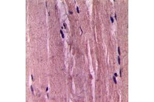 Immunohistochemistry (IHC) image for anti-Actin, alpha 2, Smooth Muscle, Aorta (ACTA2) (N-Term) antibody (ABIN7300316)