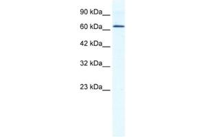 Western Blotting (WB) image for anti-DEAD (Asp-Glu-Ala-Asp) Box Polypeptide 21 (DDX21) antibody (ABIN2461344) (DDX21 antibody)