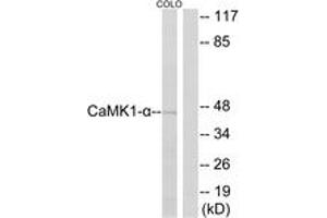 Western Blotting (WB) image for anti-Calcium/calmodulin-Dependent Protein Kinase I (CAMK1) (AA 143-192) antibody (ABIN2888788) (CAMK1 antibody  (AA 143-192))
