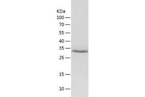 Western Blotting (WB) image for Proto-Oncogene Pim-2 (Serine Threonine Kinase) (PIM2) (AA 1-311) protein (His tag) (ABIN7124698)