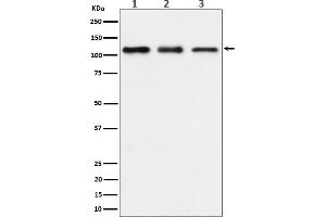 Western blot analysis of TAOK1 expression in (1) HeLa cell lysate, (2) RAW 264.