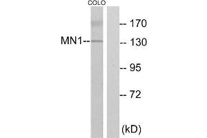 Western Blotting (WB) image for anti-MN1 proto-oncogene (MN1) (Internal Region) antibody (ABIN1849560) (Meningioma 1 antibody  (Internal Region))