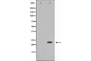 Western blot analysis on 293 cell lysate using Bak Antibody,The lane on the left is treated with the antigen-specific peptide. (BAK1 antibody  (N-Term))