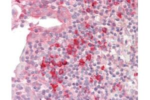 Human Tonsil: Formalin-Fixed, Paraffin-Embedded (FFPE). (SNRPD1 antibody  (AA 21-70))
