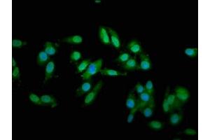 Immunofluorescence staining of Hela cells with ABIN7173586 at 1:66, counter-stained with DAPI. (Cardiac Troponin T2 antibody  (AA 138-298))