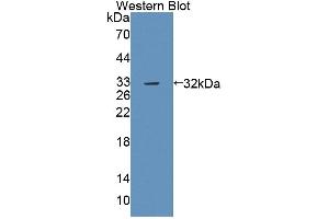 Western blot analysis of the recombinant protein. (PTPRB antibody  (AA 1214-1463))