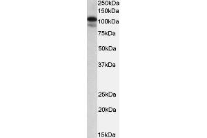 ABIN2559827 (0. (SATB1 antibody  (Internal Region))