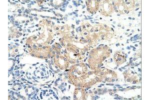 Image no. 1 for anti-Dihydrolipoyl Transacetylase (DLAT) (AA 61-110) antibody (ABIN203494) (DLAT antibody  (AA 61-110))
