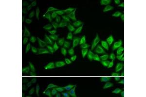 Immunofluorescence analysis of U2OS cells using TPMT Polyclonal Antibody (TPMT antibody)