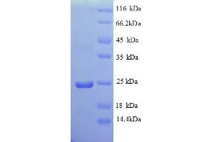 SDS-PAGE (SDS) image for Vesicle-Associated Membrane Protein 7 (VAMP7) (AA 2-181), (Cytoplasmic Domain), (Cytosolic) protein (His tag) (ABIN4975178) (VAMP7 Protein (AA 2-181, Cytoplasmic Domain, Cytosolic) (His tag))