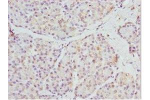 Immunohistochemistry of paraffin-embedded human pancreatic tissue using ABIN7168685 at dilution of 1:100 (FRZB antibody  (AA 166-325))