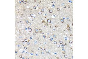 Immunohistochemistry of paraffin-embedded rat brain using Huntingtin Rabbit mAb (ABIN7267793) at dilution of 1:100 (40x lens). (Huntingtin antibody)