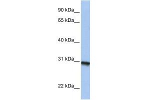 WB Suggested Anti-C20orf195 Antibody Titration: 0. (C20orf195 antibody  (N-Term))