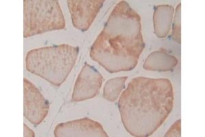 Used in DAB staining on fromalin fixed paraffin- embedded skeletal muscle tissue