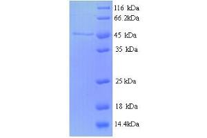 SDS-PAGE (SDS) image for Ribonucleotide Reductase M2 (RRM2) (AA 2-376) protein (His tag) (ABIN5713968) (RRM2 Protein (AA 2-376) (His tag))