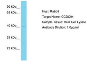 Image no. 1 for anti-Coiled-Coil Domain Containing 94 (CCDC94) (AA 239-288) antibody (ABIN6750639) (CCDC94 antibody  (AA 239-288))