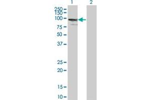 Western Blot analysis of ZNF274 expression in transfected 293T cell line by ZNF274 monoclonal antibody (M01), clone 4C12. (ZNF274 antibody  (AA 420-530))
