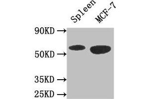Western Blot Positive WB detected in: Mouse spleen tissue, MCF-7 whole cell lysate All lanes: AMPK1 antibody at 3 μg/mL Secondary Goat polyclonal to rabbit IgG at 1/50000 dilution Predicted band size: 65, 66 kDa Observed band size: 65 kDa (PRKAA1 antibody  (Catalytic Subunit alpha))