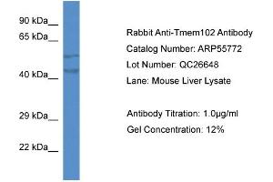 Western Blotting (WB) image for anti-Transmembrane Protein 102 (TMEM102) (N-Term) antibody (ABIN2786357)