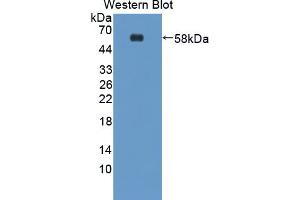 Figure. (TMEFF1 antibody  (AA 58-312))