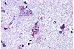 Anti-EDG7 antibody  ABIN1048537 IHC staining of human brain, amygdala. (LPAR3 antibody  (Cytoplasmic Domain))