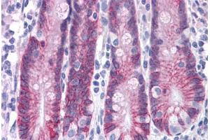 Human Small Intestine: Formalin-Fixed, Paraffin-Embedded (FFPE) (ASAH2 antibody  (C-Term))