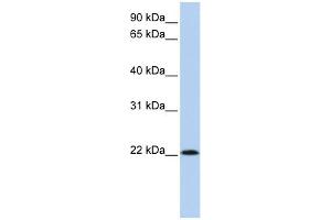WB Suggested Anti-RNASE11 Antibody Titration: 0. (RNASE11 antibody  (Middle Region))